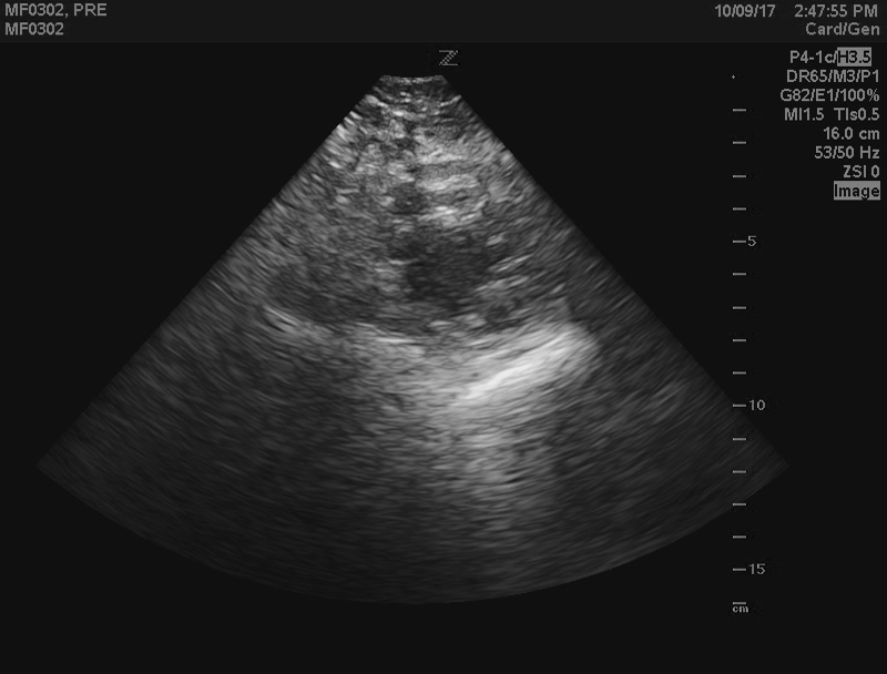 B-mode echocardiogram of short-axis apex view
