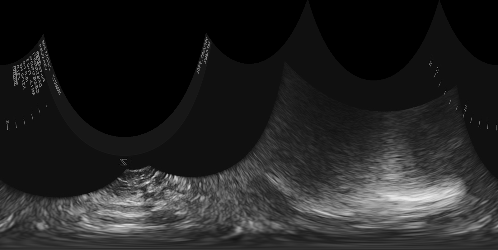 Polar image of echocardiogram of short-axis apex view